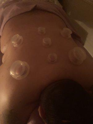 Cupping services