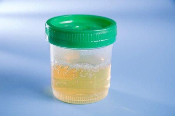 Urine collection