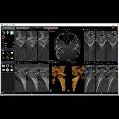 Computer Guided Imaging