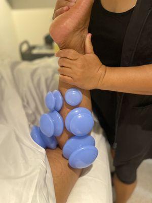 NeuroMuscular Cupping Technique