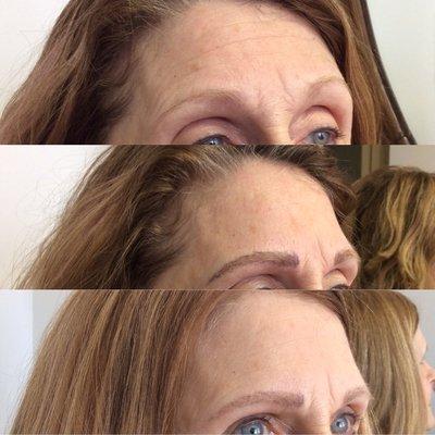 Before, minutes after and the healed results of a brow procedure on a beautiful red head with sparse natural eyebrows.