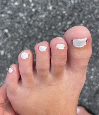 The worst pedicure ever!