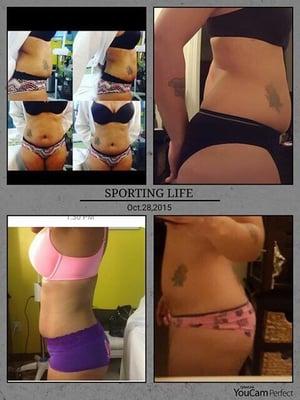 This is  bodyshaping results 3wks post three treats.