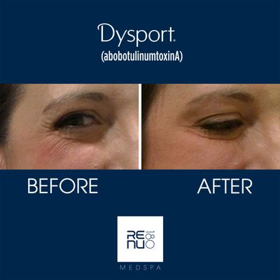 #Dyspot Results!