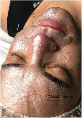 Facial