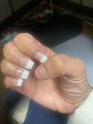 My nails with the first nail missing.