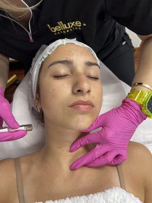 Microdermabrasion