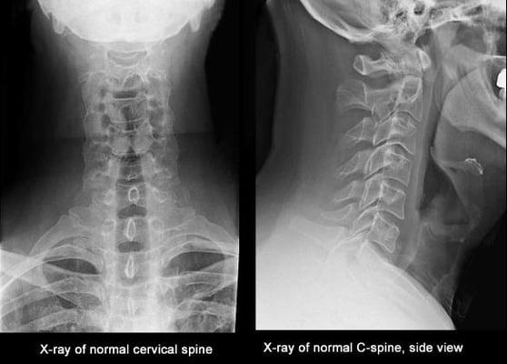 Onsite digital Xray