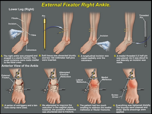 Custom Medical Illustration