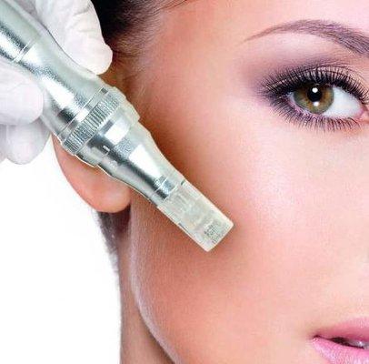 Medical Micro-Needling