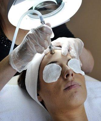 Diamond microdermabration