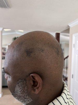 Patches of hair left by the barber