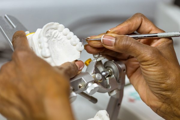 General Dentistry in Chicago | Cosmetic Dentists in Chicago | Endodontist Chicago Dental Implants, Veneers, Crowns & Bridges