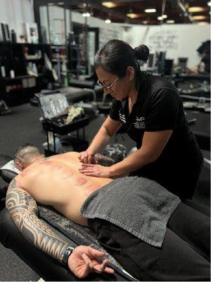 AMP Sports Med & Recovery's Specialist Veronica Jacquez in Temecula: Cupping,  Myofascial Release, reduce pain and inflammation ..