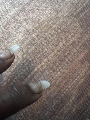 Nail lifting from the bottom