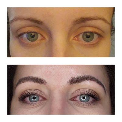 Microblading