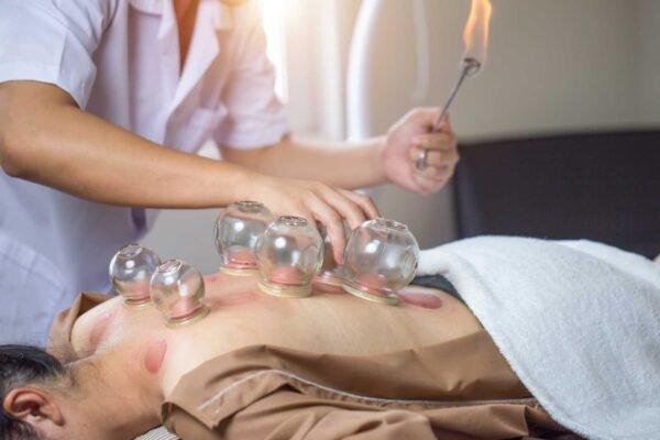 Cupping Therapy