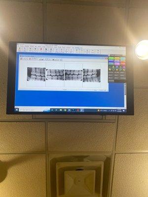 Our software system allows for patients to view their x-rays with Doctor, and discuss their current oral health.