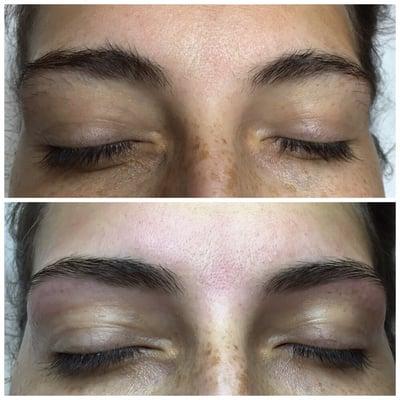 Before and after brow rehab!