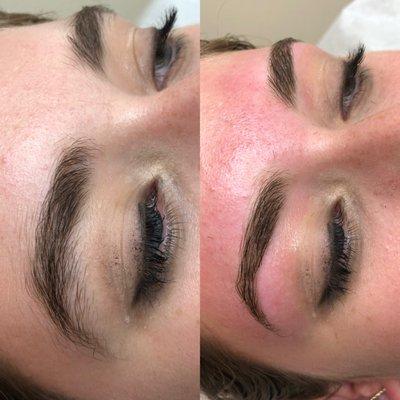 Brow transformation.