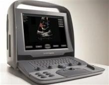 cypress plus Ultrasound machine