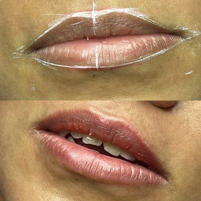 Lip neutralization