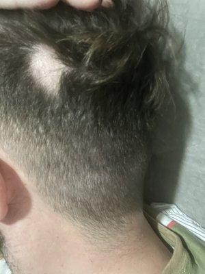 Missing patch of hair from July 2022 cut