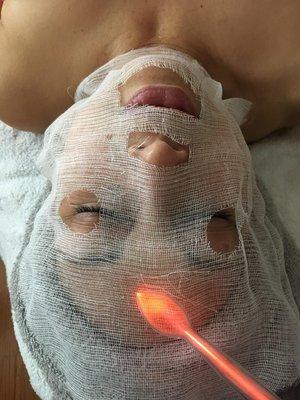 High Frequency Facial