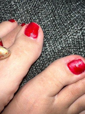 poorly done pedicure