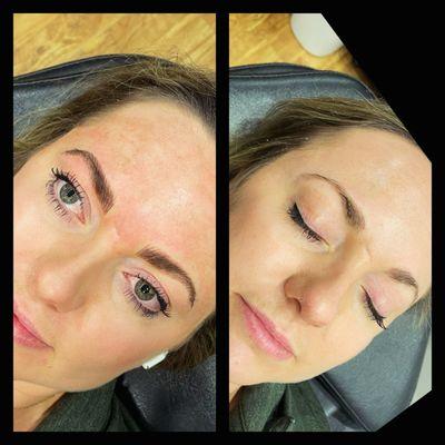 Microblading