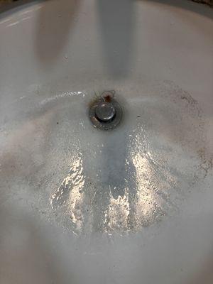 Dirty sink.