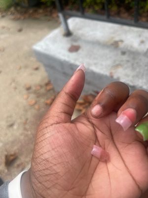 Tried to show how some nails where lifting and while trying to capture the gap the nail popped off