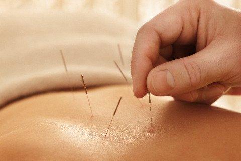 Acupuncture is safe and effective.