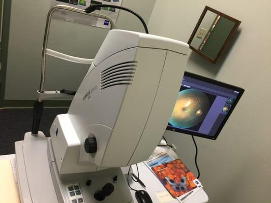 Our New Zeiss Cirrus Photo scan Acquisition 600 Joseph Cohen Optometrist in Woodland Hills, California