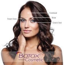 Botox Injections