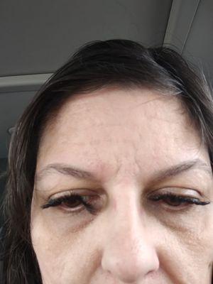 Bad eyelash job