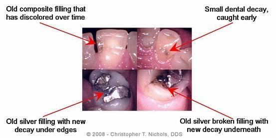 Intraoral Camera Documentation