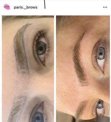 Microblading