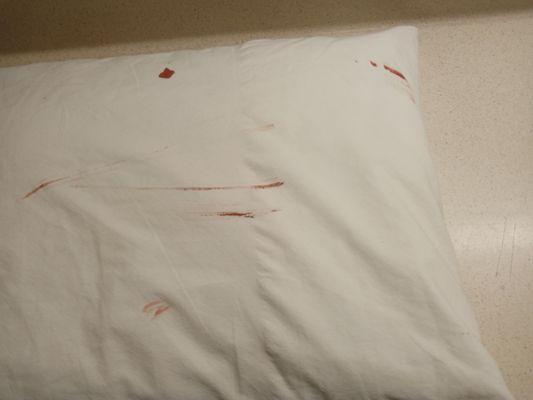 Blood on the pillow