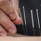 Balanced Health Acupuncture