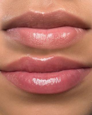 Lip Neutralization