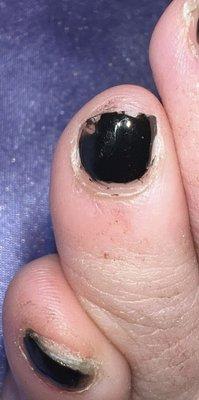 not sure if the nail tech knew the polish goes on the nail and not the skin