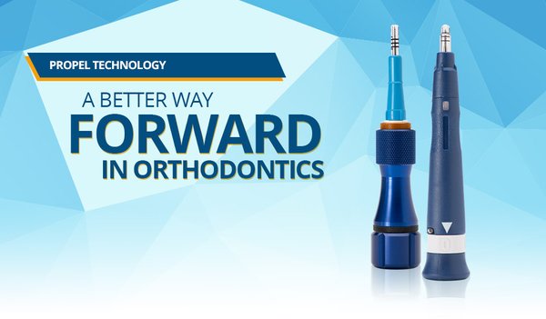 Learn more about the leading product in accelerated tooth movement from the INVENTORS at CTOR Orthodontics, specialists in fast treatment