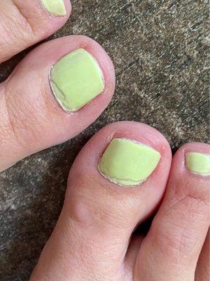 Big toes don't look so great.