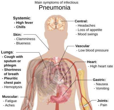 We offer Pneumonia vaccines.