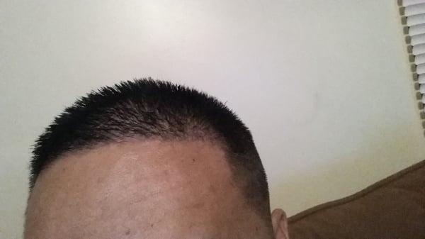 I asked for High skin fade and this is not a high, skin fade.