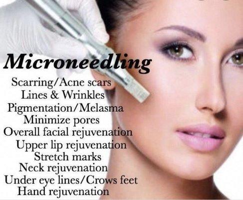 Microneedling is available here!