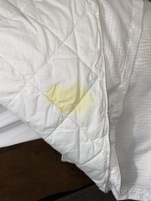 Yellow stains on comforter