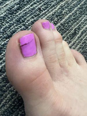 my "NO-CHIP, GEL PEDICURE" chipped like this after a handful of days! $171 wasted...