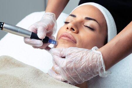 Dermapen Facial